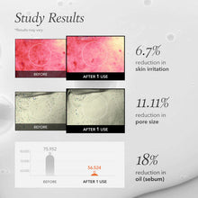 Load image into Gallery viewer, April Skin Carrotene IPMP™ Instant Calming Serum Pads 80EA