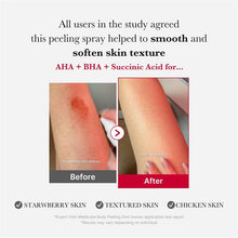 Load image into Gallery viewer, medicube Red Acne Body Peeling Shot 2.0 110g