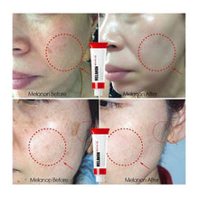 Load image into Gallery viewer, MEDI-PEEL Melanon X Cream 30ml