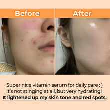 Load image into Gallery viewer, Numbuzin No.5 Goodbye Blemish Serum 50ml