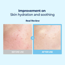 Load image into Gallery viewer, Torriden DIVE-IN Low Molecule Hyaluronic acid Multi Pad 80EA