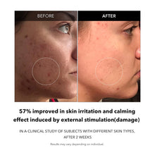 Load image into Gallery viewer, APRILSKIN Carrotene Clarifying Serum 37ml