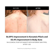 Load image into Gallery viewer, April Skin Carrotene IPMP Exfoliating Body Wash 300ml