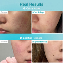 Load image into Gallery viewer, Numbuzin No.1 Pantothenic B5 Hyaluronic Active Clear Mask 4EA