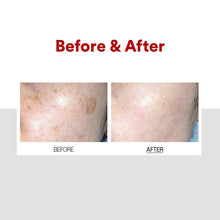 Load image into Gallery viewer, MEDI-PEEL Melanon X Cream 30ml