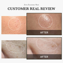 Load image into Gallery viewer, Medicube One-Day Exosome Shot Pore Ampoule 2000 30ml