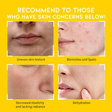 Load image into Gallery viewer, OOTD Dark Spot Vitamin C Toner Pad 70EA