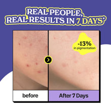 Load image into Gallery viewer, Vividraw Niacin Onion All Clear Serum 40ml