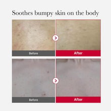 Load image into Gallery viewer, medicube Red Acne Body Peeling Shot 2.0 110g