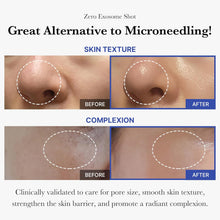 Load image into Gallery viewer, Medicube One-Day Exosome Shot Pore Ampoule 2000 30ml