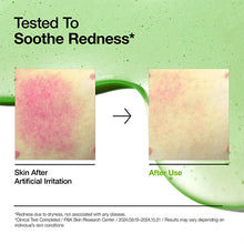 Load image into Gallery viewer, Anua: Redness Relief & Spot Correcting Duo