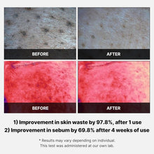 Load image into Gallery viewer, MEDICUBE Red Succinic Acid Peeling Pad 70EA