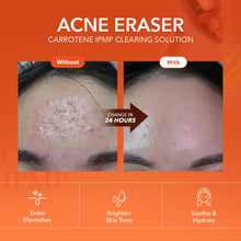 Load image into Gallery viewer, April Skin Carrotene Clearing Solution 20ml
