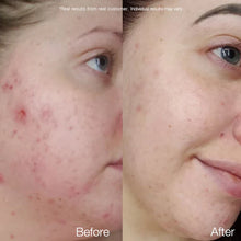 Load image into Gallery viewer, APRILSKIN Carrotene Clarifying Serum 37ml