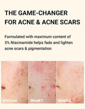 Load image into Gallery viewer, April Skin Carrotene Clearing Solution 20ml