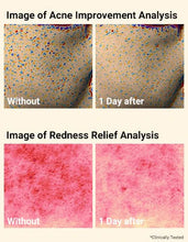 Load image into Gallery viewer, April Skin Carrotene Clearing Solution 20ml