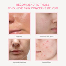 Load image into Gallery viewer, OOTD Clarifying Niacinamide Serum 50ml