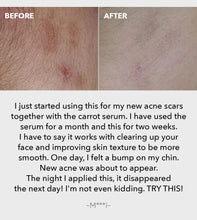 Load image into Gallery viewer, April Skin Carrotene Clearing Solution 20ml