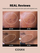 Load image into Gallery viewer, Cosrx The Alpha-Arbutin 2 Discoloration Care Serum 50ml