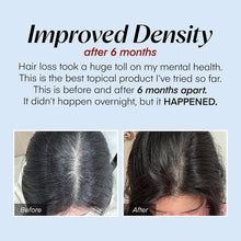 Load image into Gallery viewer, Seapuri Scalpy Hair Serum 20ml