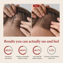 Load image into Gallery viewer, KUNDAL Caffeine Shampoo 500ml #Cherry Blossom