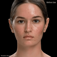 Load image into Gallery viewer, April Skin Carrotene Clearing Solution 20ml