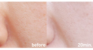 [1+1] Skinmiso Pore Corset Serum 30ml