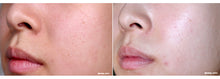 Load image into Gallery viewer, Skinmiso Pore Corset Serum 30ml - Exp:10.04.2025