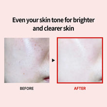 Load image into Gallery viewer, MEDI-PEEL Melanon X Ampoule 50ml