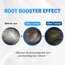 Load image into Gallery viewer, Seapuri Scalpy Hair Serum 20ml