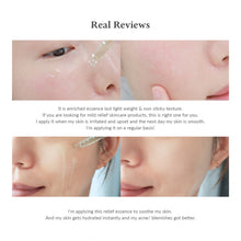 Load image into Gallery viewer, Dr.Althea Skin Relief Essence 30ml
