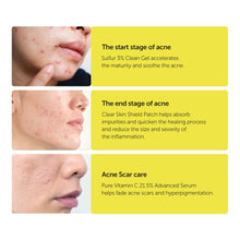 Load image into Gallery viewer, By Wishtrend Sulfur 3% Clean Gel 30g