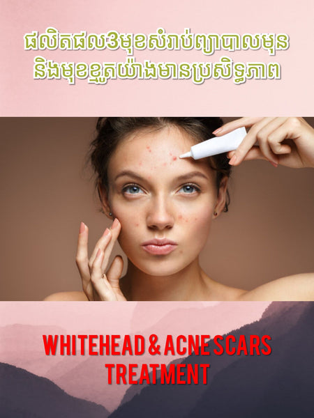 Acne & Pigmentation Free