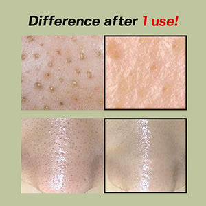 SUNGBOON EDITOR Green Tomato Pore Peeling Jumbo Pad 180ml