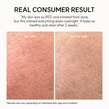 Load image into Gallery viewer, ARENCIA Eraser Soothing Cream 50ml