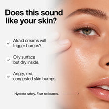 Load image into Gallery viewer, ★Renew★ Nineless A-Control Azelaic Acid Cream 50ml