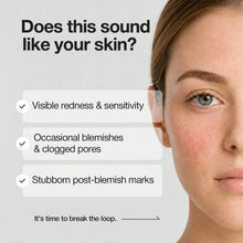Load image into Gallery viewer, [Renew] NINELESS A-Control 10% Azelaic Acid Serum 30ml