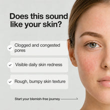 Load image into Gallery viewer, Nineless A-control Azelaic Acid Toner 150ml