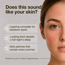 Load image into Gallery viewer, ★Renew★ Nineless B-Boost 1% Kojic Acid Serum 30ml