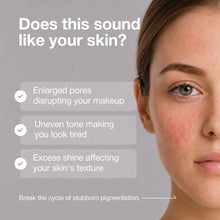 Load image into Gallery viewer, NINELESS B-Boost 22% Niacinamide Serum 30ml
