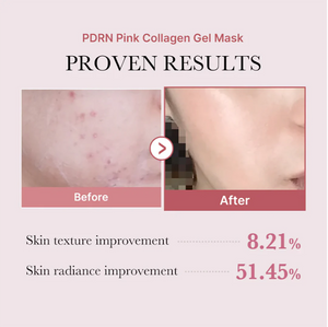 Medicube PDRN Pink Collagen Gel Mask