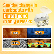 Load image into Gallery viewer, Numbuzin No.5+ Vitamin Glutathione Dark Spot Laser 50ml