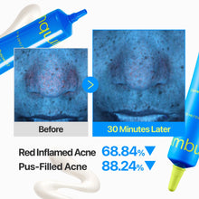 Load image into Gallery viewer, NumbuzinNo.0 Zero Blemish 3X Spot Correcting Cream 20ml