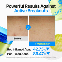 Load image into Gallery viewer, Numbuzin No.0 Zero Blemish Azela Cica Balancing Dual Pads 60EA