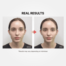 Load image into Gallery viewer, MEDITHERAPY Shumage EMS Device