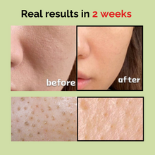 Load image into Gallery viewer, mommycare Sea Grape Ampoule 50ml