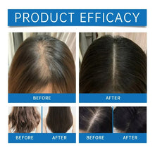 Load image into Gallery viewer, Seapuri Scalpy Hair Serum 20ml