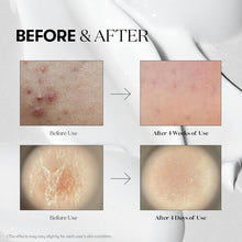 Load image into Gallery viewer, VT Cosmetics Reedle Shot 50 30ml