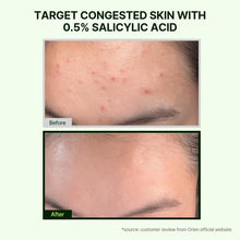 Load image into Gallery viewer, Orien Mugwort Zero Film Cleansing Foam 150ml