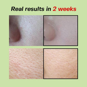 SUNGBOON EDITOR Green Tomato Pore Zero Ampoule+ 40ml